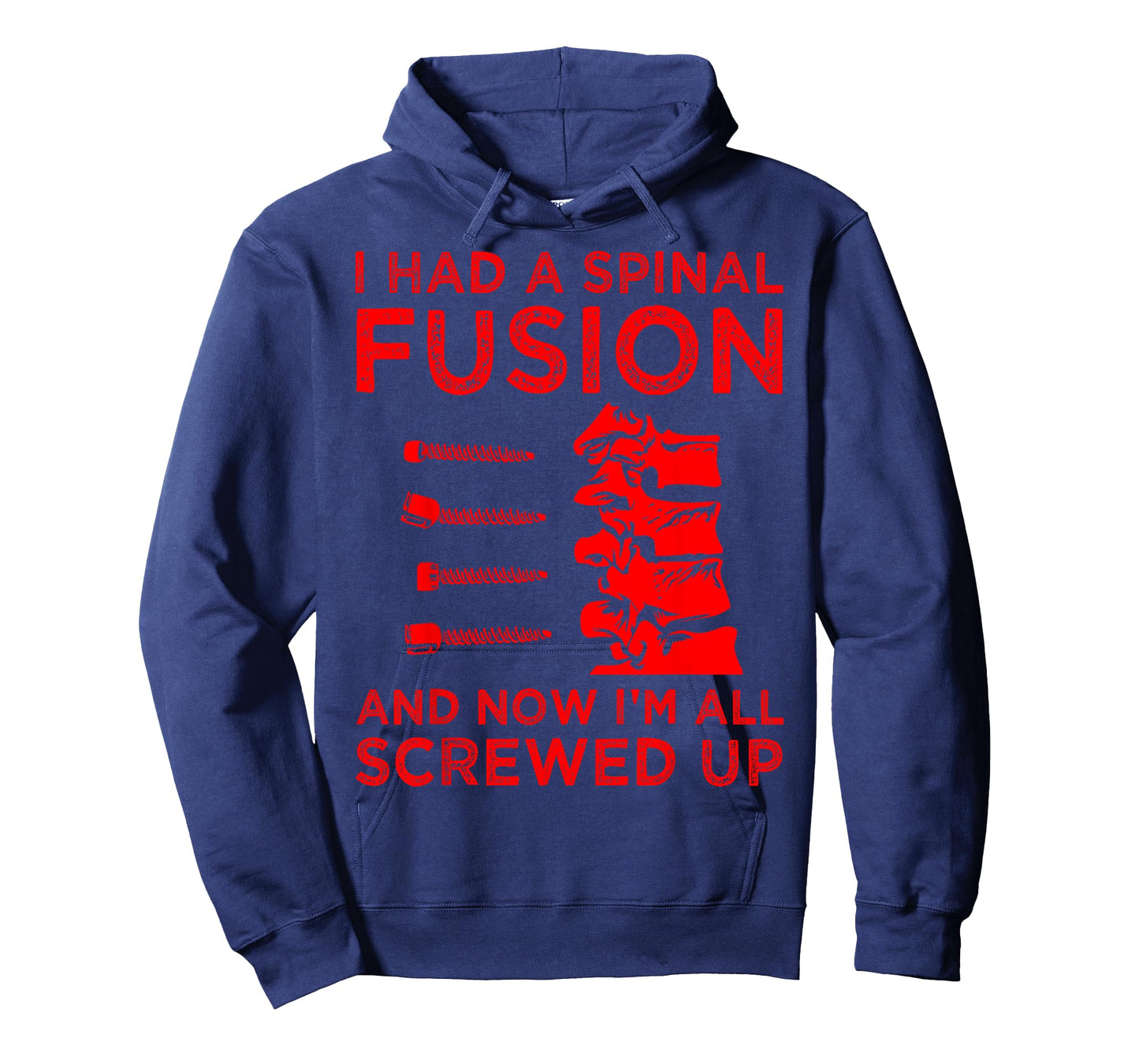 Cool Scoliosis Spinal Fusion Gift Back Surgery Recovery Gift T-Shirt