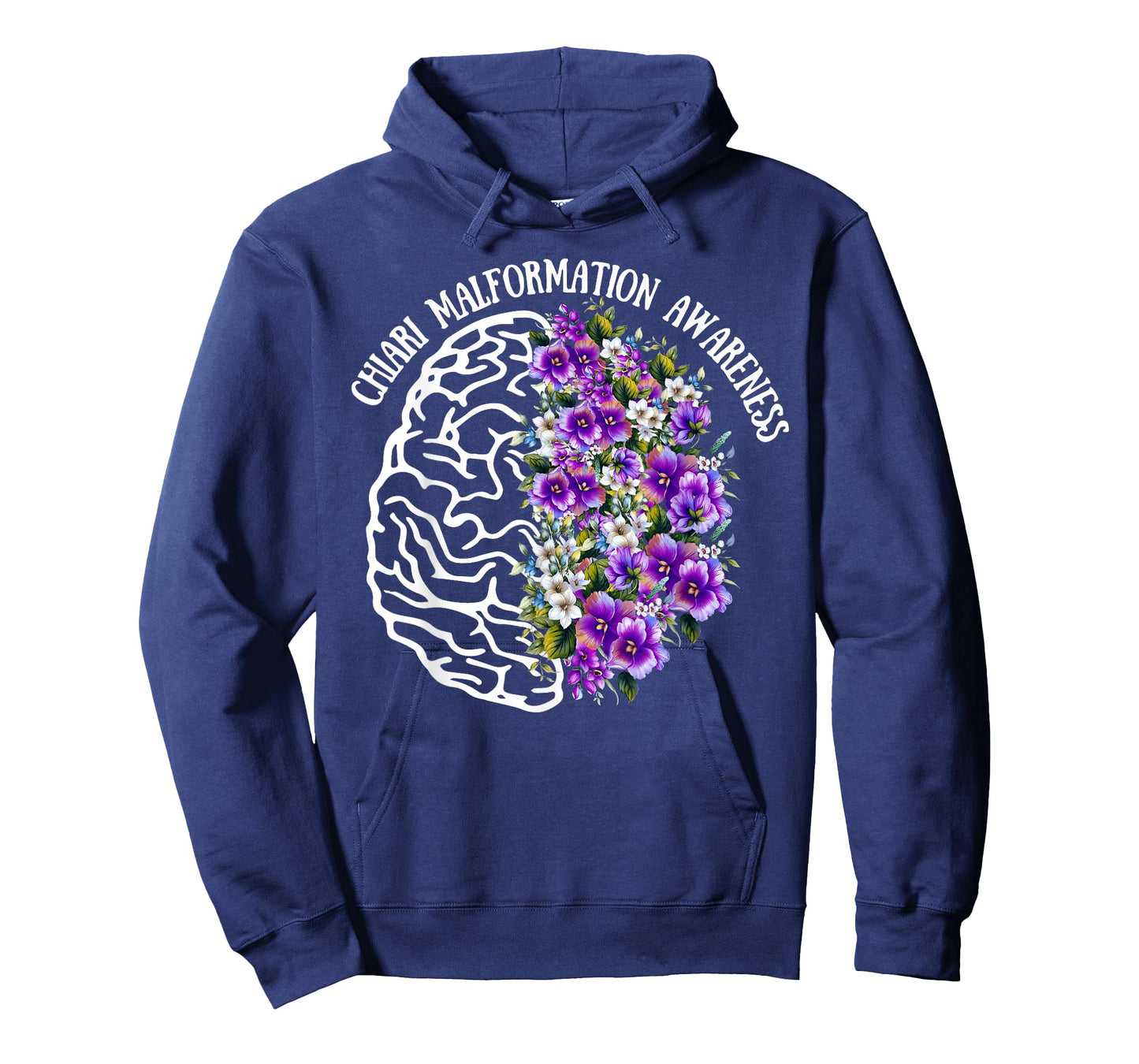 Chiari malformation - ACM awareness - zipperhead - brain T-Shirt